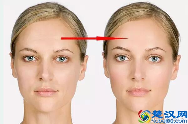抬头纹去除方法 养成不皱眉的习惯