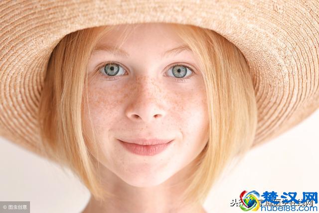 如何辨别脸上的斑是哪种斑？分清种类才好祛斑