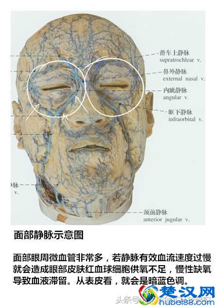 常年黑眼圈怎么回事？拒绝熊猫眼，击退黑眼圈！