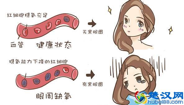 常年黑眼圈怎么回事？拒绝熊猫眼，击退黑眼圈！