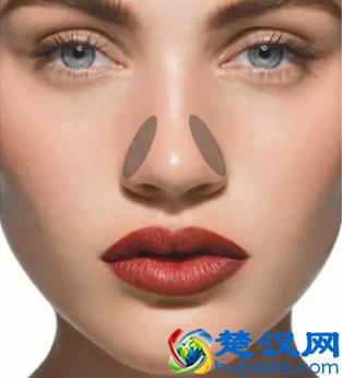 缩小鼻翼按摩方法，照这样按摩5天按出小鼻翼