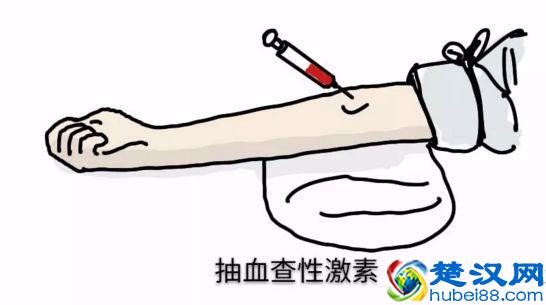 性激素六项的最佳检查时间？其实不同时间意义不同！