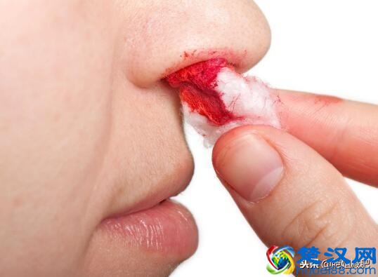小常识：流鼻血4个错误的处理方法，很多人一直在用，你了解几个