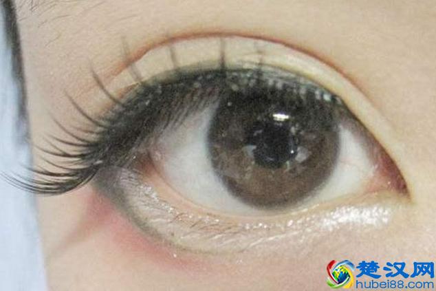 如何把小眼睛变大，这样方法你可能不知道