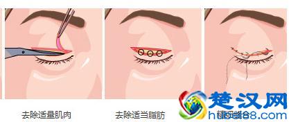 如何把小眼睛变大，这样方法你可能不知道