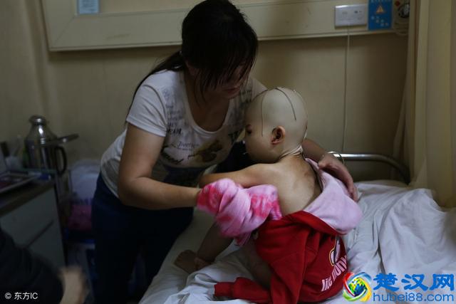 孩子在家发烧怎么办？儿科医生：学会这3招物理降温，很实用！