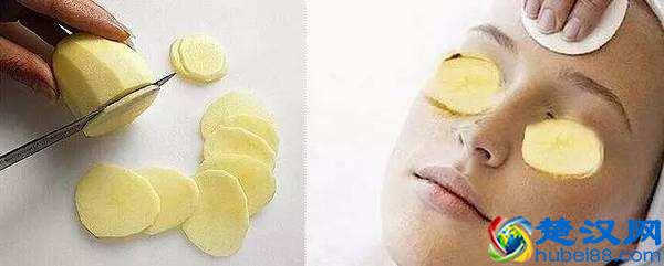 讨人厌的眼袋怎么去除?教你4个方法,轻松解决问题