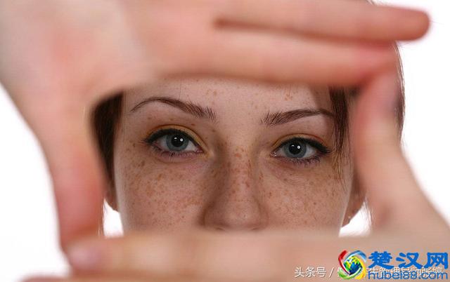 如何判断是不是遗传雀斑，什么叫雀斑，一招帮你祛斑