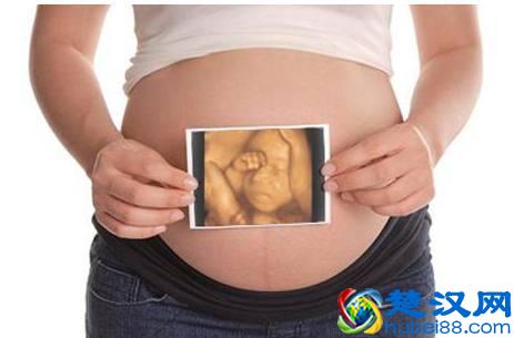 四维彩超那么贵，准妈妈要看懂，不然钱白花了！