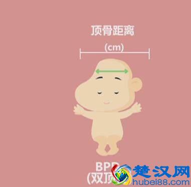 四维彩超那么贵，准妈妈要看懂，不然钱白花了！