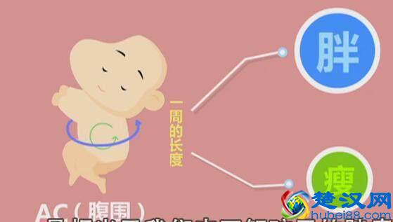 四维彩超那么贵，准妈妈要看懂，不然钱白花了！