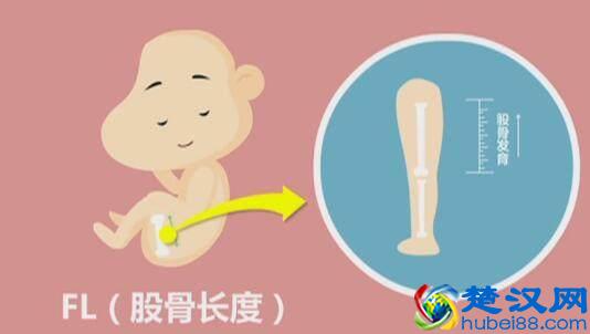 四维彩超那么贵，准妈妈要看懂，不然钱白花了！