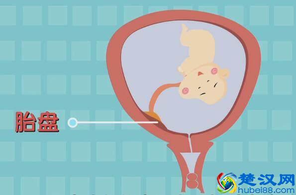 四维彩超那么贵，准妈妈要看懂，不然钱白花了！