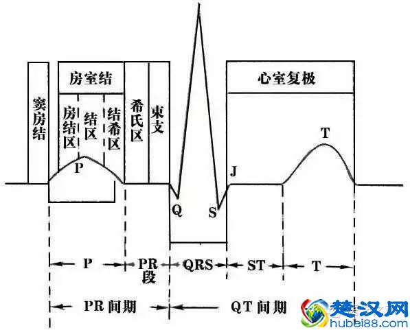 这么教你看心电图，还有什么理由看不懂？