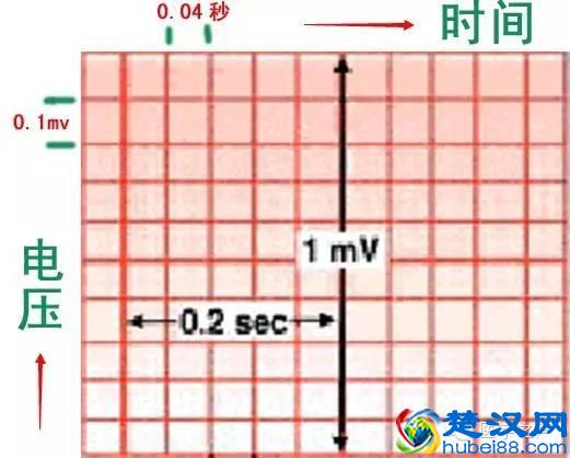 这么教你看心电图，还有什么理由看不懂？