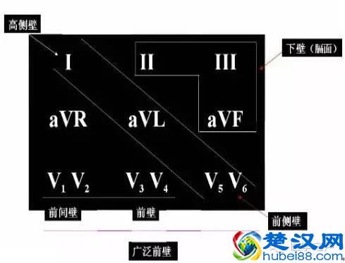 这么教你看心电图，还有什么理由看不懂？