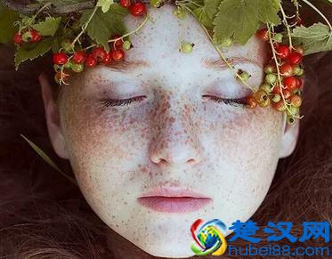 遗传性的雀斑能去掉吗，什么办法比较好？