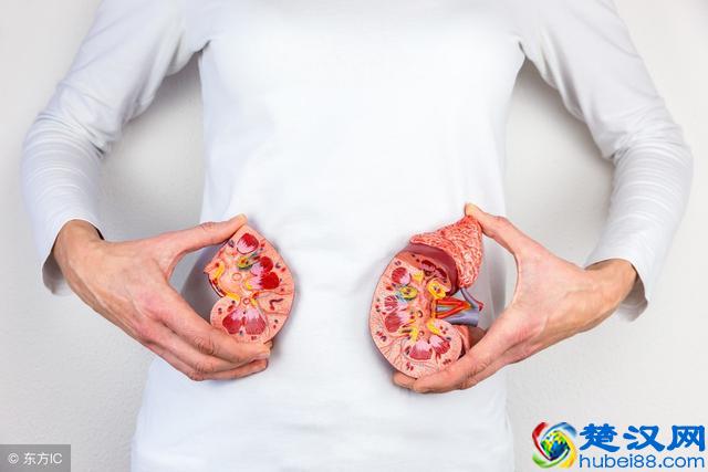 肾结石是怎么导致的？有这几个坏习惯的人十有八九跑不掉