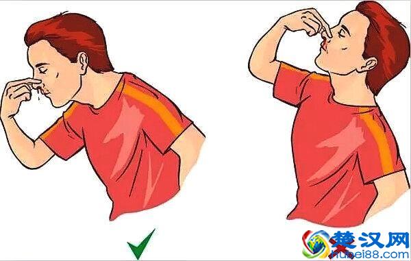 突然流鼻血应该怎么办，教你两招让你不必惊慌！