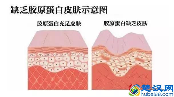 和光子嫩肤有关的核心问题，看这篇就够了！