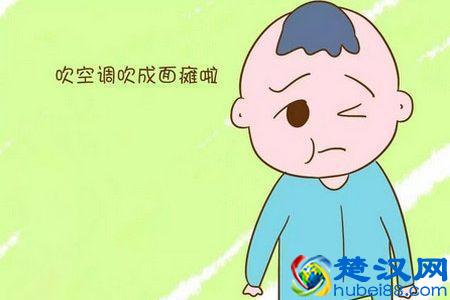 真正的面瘫是什么样子？为什么会有面瘫发生？