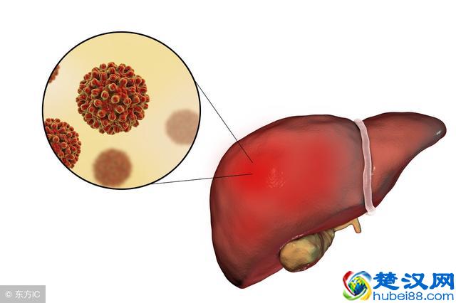 什么是乙肝小三阳？乙肝小三阳该如何进行治疗？