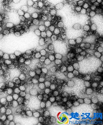 诺贝尔的发明和他的”以毒攻毒“的想法