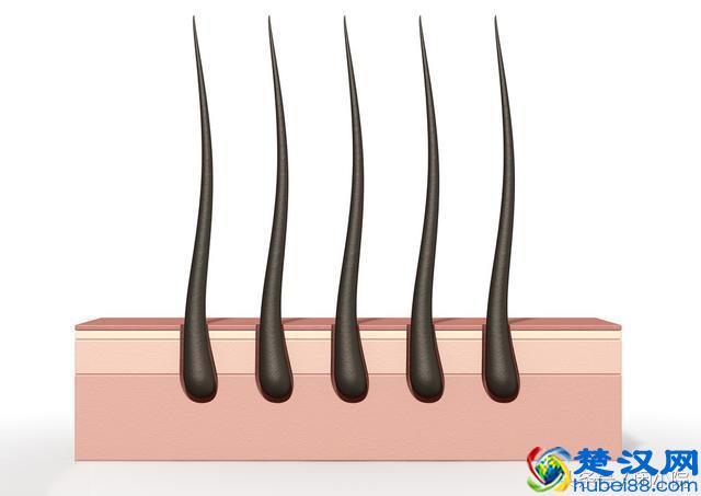 脱发、斑秃、早秃、脂溢性脱发，中医这么讲，这样吃对头发好