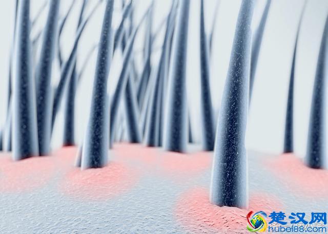 脱发、斑秃、早秃、脂溢性脱发，中医这么讲，这样吃对头发好