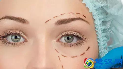 如何祛除眼袋黑眼圈？靠谱的方法在这里