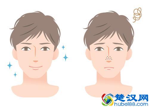 男生如何收缩皮肤毛孔？有哪些有效的护肤品？