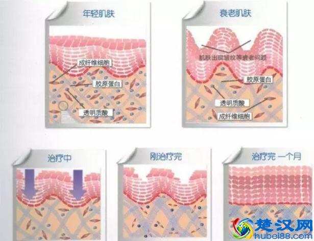 12款安耐晒防晒霜你选对了吗？这里有一份详细的安耐晒选购指南