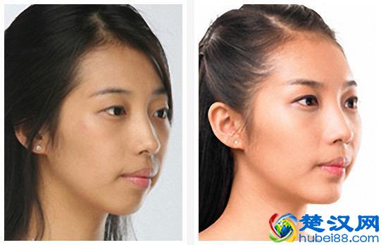 12款安耐晒防晒霜你选对了吗？这里有一份详细的安耐晒选购指南