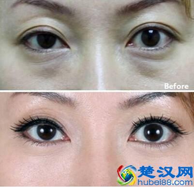 吹空调为什么要放盆水 开空调喉咙痛怎么办