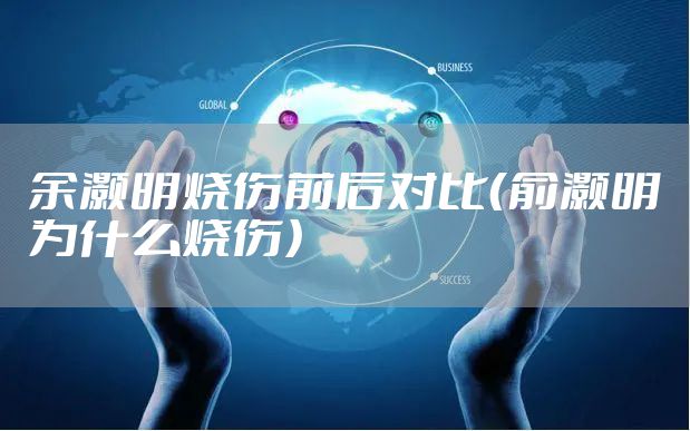 余灏明烧伤前后对比（俞灏明为什么烧伤）