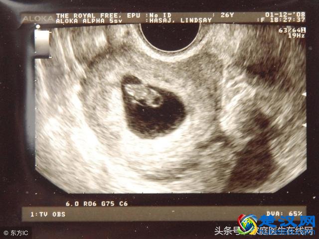 子宫肌瘤饮食要注意什么？这5种食物，建议你多吃几口