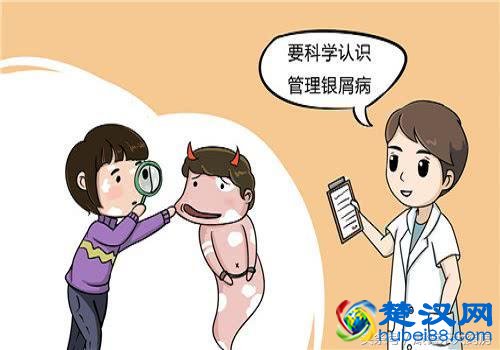 偏方治疗牛皮癣的方法可行吗？这里告诉您，不看别后悔