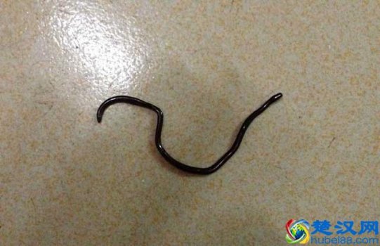  铁线虫是什么？铁线虫寄生在人体会怎么样？带你了解铁线虫的真实面目