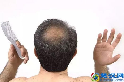  头发少怎么办，教你几个生发秘籍！