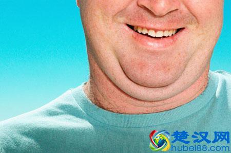  怎么去除双下巴（教你几个超级有效的好办法）