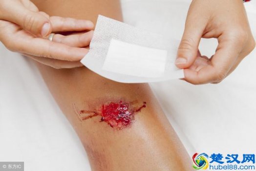  疥疮是怎么引起的，什么是疥疮！