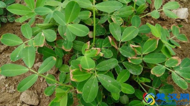  经常失眠怎么办，教你几个妙招解决！