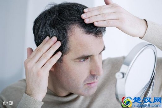  防脱发洗发水哪个好？10大最好用的洗发水排名