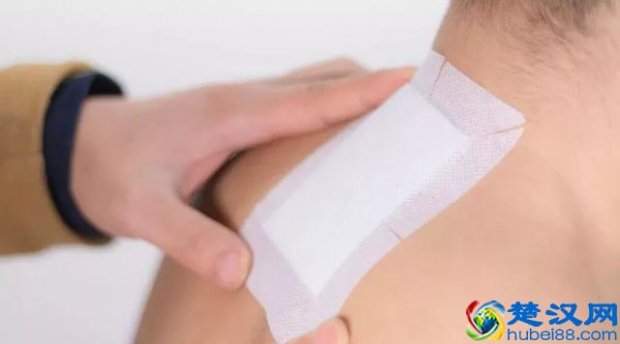  膏药怎么洗（膏药怎么洗掉最快不疼的方法）