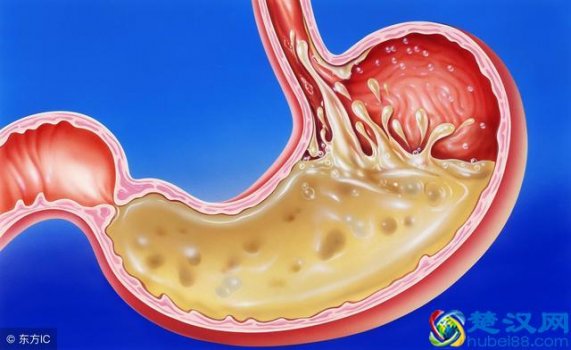  胃炎吃什么药（关于胃炎的用药，这5点你要知道）