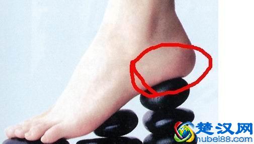  脚后跟疼是什么原因？别忽略了身体的小毛病