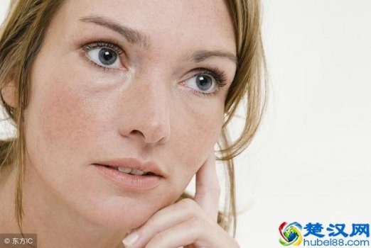  黄褐斑注意事项（如何预防黄褐斑）