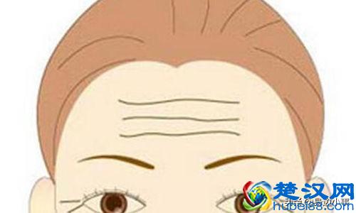  15岁男生有抬头纹怎么办（男人有抬头纹代表什么）