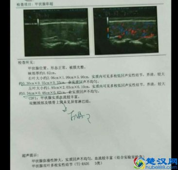  甲状腺低回声结节是怎么回事，该怎么调理！