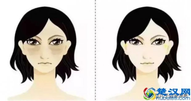  怎么祛眼袋的简单方法？简单有效的方法，赶紧试试